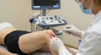 For Chronic Knee Pain, Genicular Artery Embolization Provides a New Alternative