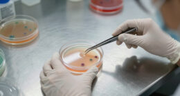 Louisiana Vibrio Vulnificus Outbreak